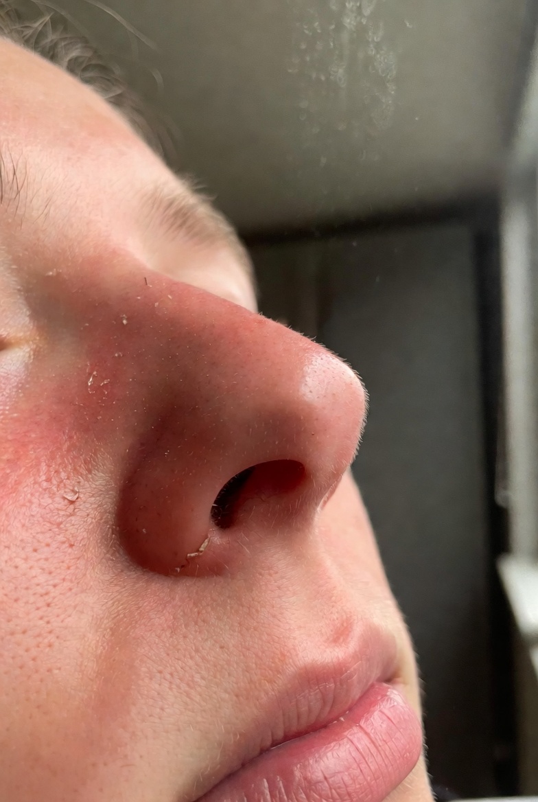 過敏族梅雨季：濕度目標怎麼訂才不刺激